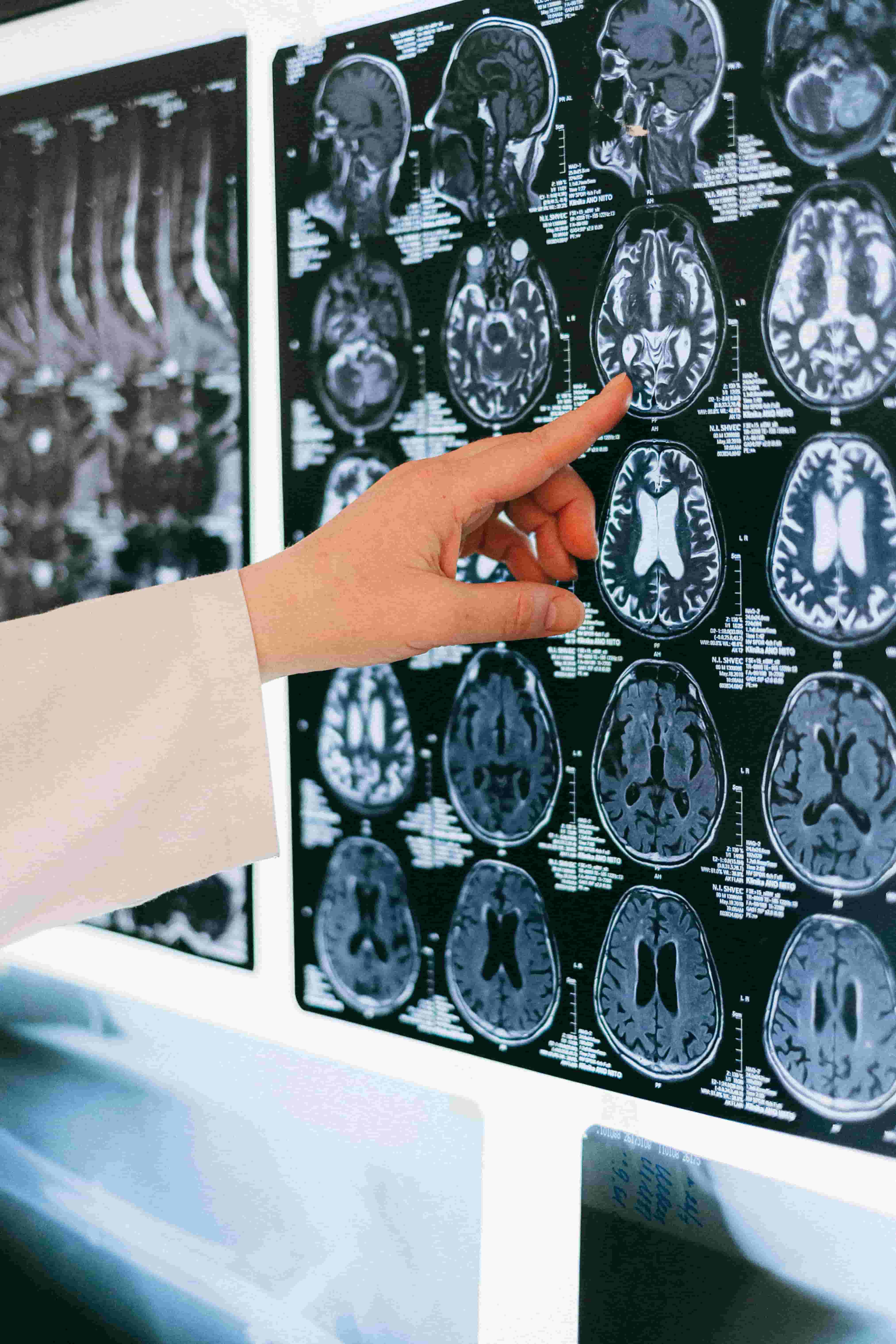 Brain activity visualization showing different sleep stages and memory processing